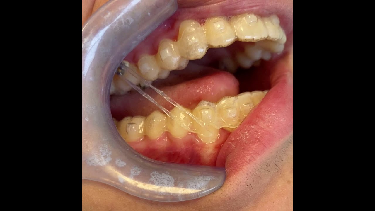 Finale Per Bastone Futura Cilindro In Metallo 20mm Nickel Satinato INSPIRE 2 Pezzi | Leroy Merlin - Foto 2