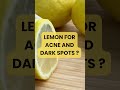 “Putting Lemon on Your Face? #naturalremedies