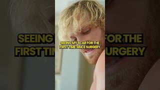 SEEING MY SCAR FOR THE FIRST TIME SINCE SURGERY #loganpaul #wwe #shorts