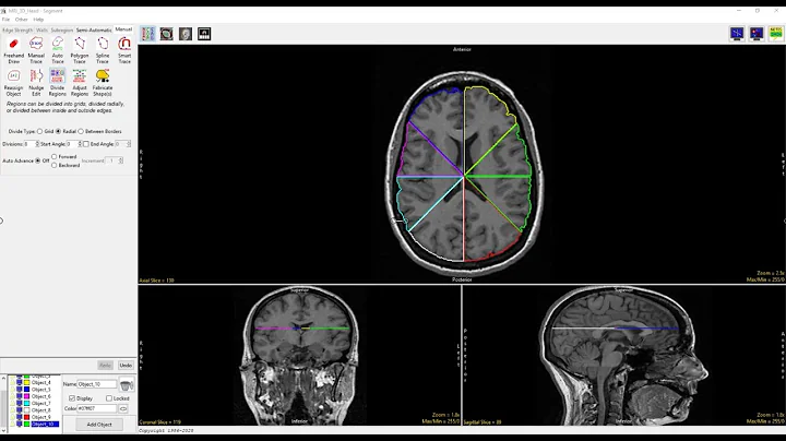 Analyze 14.0 - Segment: Divide Regions into Radial Sections