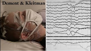 Dement & Kleitman| Sleep and Dreams| AS Level| Revision| Psychology 9990| CAIE 2023