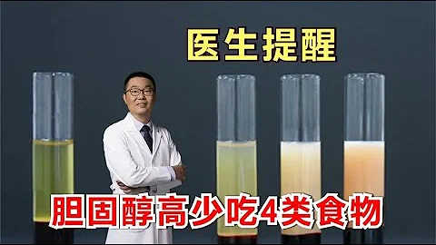 膽固醇高，血脂高，要少吃哪些食物？醫生警告：4類食物要少吃！ - 天天要聞