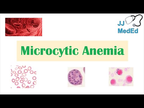 Microcytic Anemia & Causes (Iron Deficiency, Thalassemia, Anemia of Chronic Disease, Lead Poisoning)