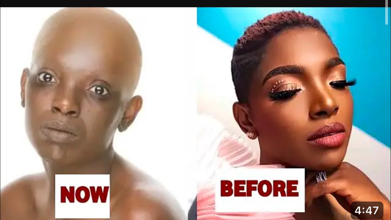Idibia Annie Idibia et 2face dans les conditions très critique apres avoir eu ...