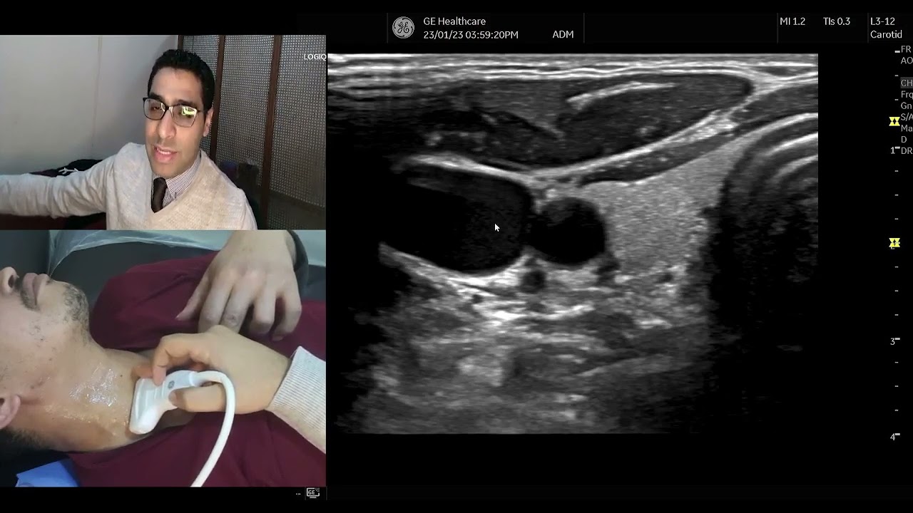 Demonstration of Carotid doppler technique  (Arabic)