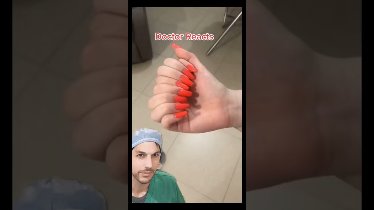 How many fingers is that? #Polydactyly #Fingers #Hand #MedicalStudent #Dr #Extra #Congenital