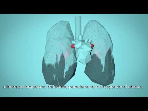 OMS: Respira la Vida - Cómo la contaminación del aire afecta a tu cuerpo