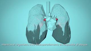 OMS: Respira la Vida - Cómo la contaminación del aire afecta a tu cuerpo