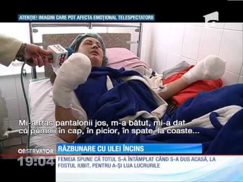 Video: Iubitul A Aruncat O Fată Desfigurată De Uleiul Care Fierbe - Dar își Arată Cu îndrăzneală Fața