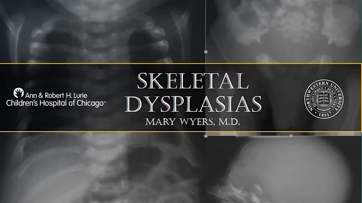 Skeletal Dysplasias