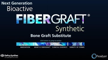 Fibergraft