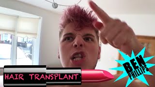 Ben Phillips | Hair Transplant PRANK - Elliot's finally come out