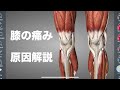 膝の痛みの原因をいろいろな角度から解説してみた