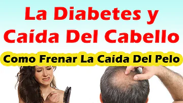 ¿Puede la diabetes provocar la caída del cabello?