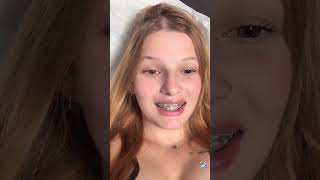 Ellin Periscope, Live 251