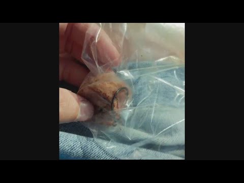 Alexandria pet owners warned after sausage found with fish hooks embedded inside