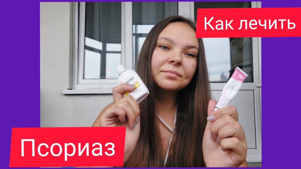 псориаз//как я лечусь от псориаза//как избавиться от псориаза//как ...