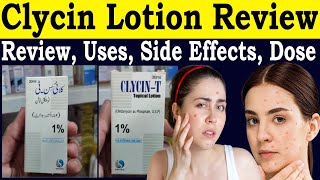 Clycin T Lotion How To Use - Review Clycin T Lotion For Acne - Clindamycin Lotion For Acne, Uses