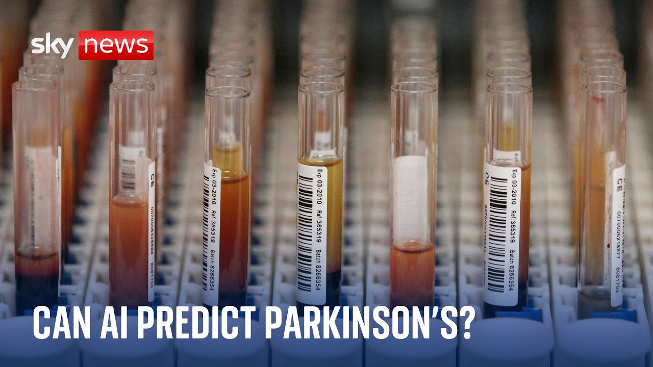 AI blood test predicts Parkinson’s years before first symptoms