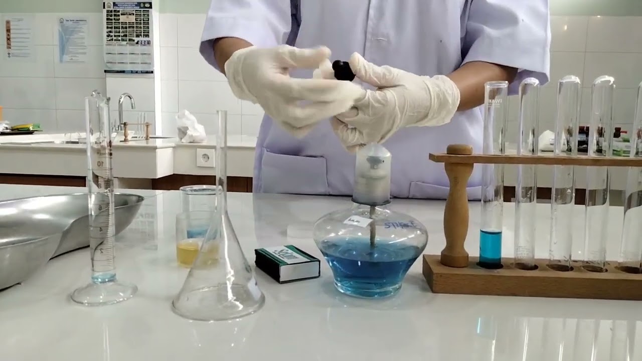 Praktikum Pemeriksaan Glukosa Urine