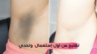 سواد 20 سنه ساينتهي بمسحه واحده فقط تبيض الجسم