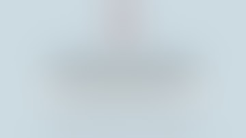 Anterior gastric wall GIST: laparoscopic atypical gastrectomy using ultrasonic scalpel