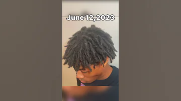 My 1 year dread journey #shorts #short #dreadjourney #dreads #freeformdreads #locs #kaicenat