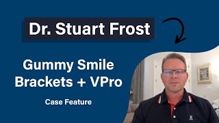 Dr. Stuart Frost | Gummy Smile Case Feature | Propel Orthodontics screenshot 3