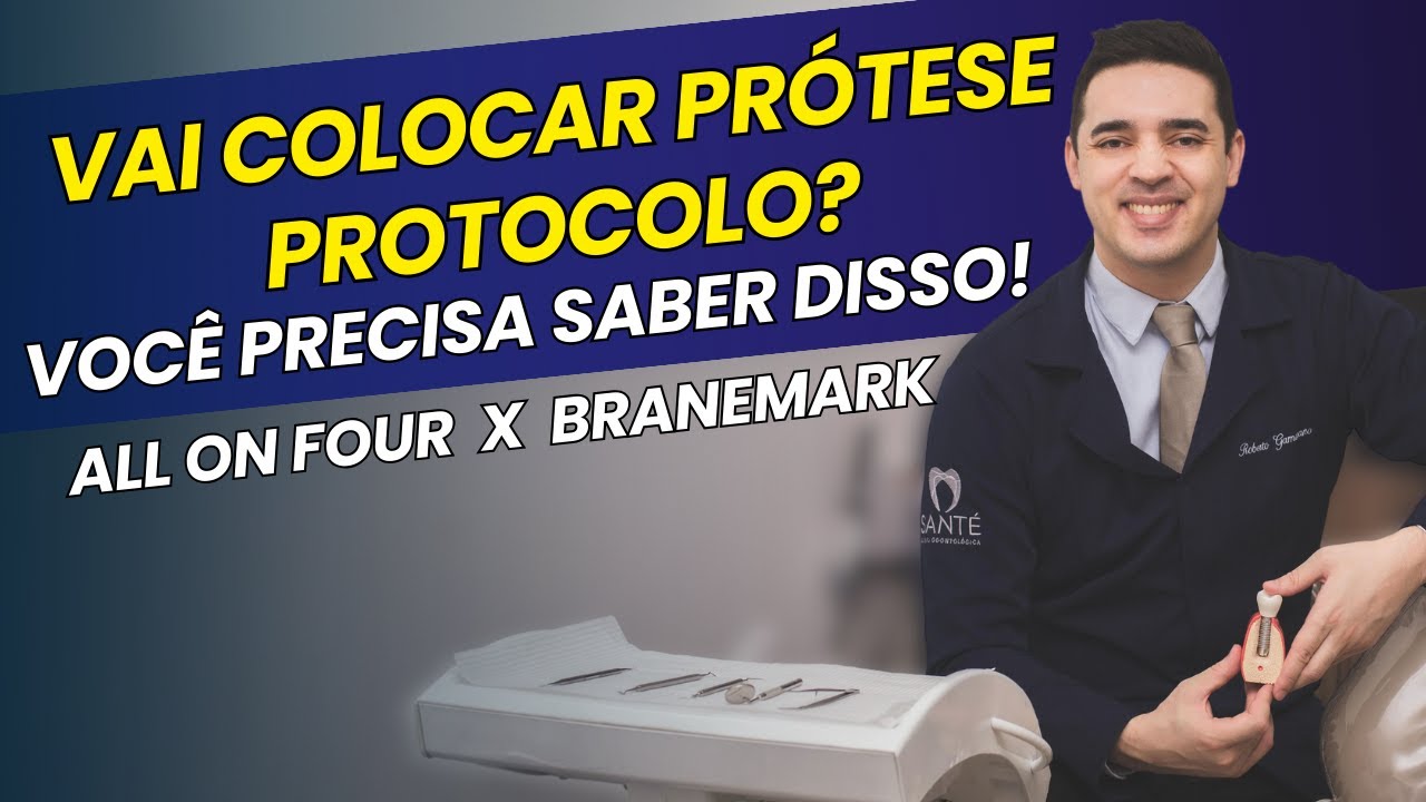 Protocolo Branemark X All On Four com Carga Imediata em Belo Horizonte - Dicas que não tem preço!!!