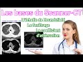 4 notions de base du scannerct tdm coefficient dattnuation unit chelle de houndsfield