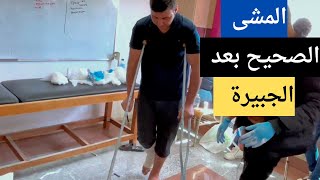 جبيرة للقدم /وازاى المريض يمشى باستخدام العكازات