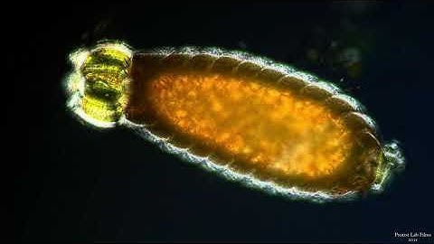 𝘾𝙝𝙖𝙧𝙖 - Oogonium