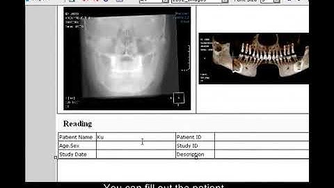X Report Select Template form Insert Print