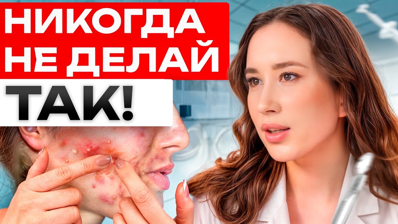 Механическая ЧИСТКА лица опасна для КОЖИ? / Как БЕЗОПАСНО избавиться от ...