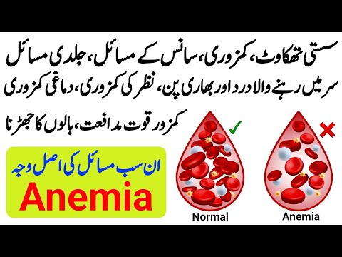 Anemia Deficiency ka masla koi Choti baat nahi