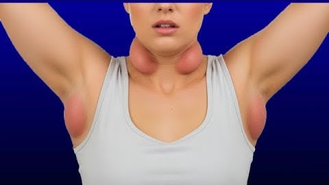 How Cancer Spread To Lymph Nodes?