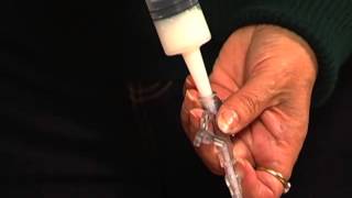 Tube Feeding - How to Take Medication Through Feeding Tube