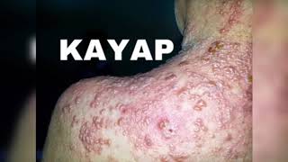 Ruqyah Yang Dapat Merawat Masalah Kayap Youtube
