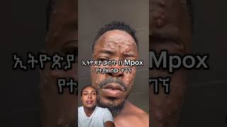 Mpox in ethiopia #mpoxvirus #foryou #ethiopiannews #bbcnews @ebstvWorldwide @ETV