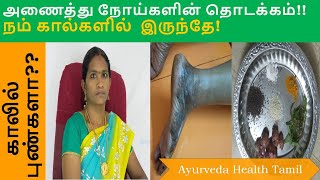 அணைத்து விதமான  கால் புண் விரைவில் குணமாக | குதிங்கால் புண் | cure foot skin disease