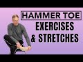 Top 5 Hammer Toe Stretches & Exercises (Avoid Surgery) (Toe Ext. Stretch)