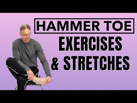 Top 5 Hammer Toe Stretches & Exercises (Avoid Surgery) (Toe Ext. Stretch)