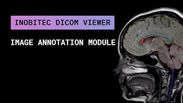 Image annotation additional module in Inobitec DICOM Viewer Pro
