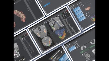 DentalLAB: The AI ​​Revolution in Dental Imaging | CT/CBCT Segmentation | IOS Segmentation | Fusion