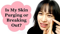 Is My Skin Purging or Breaking Out? | Lab Muffin Beauty Science