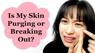 Have you had that awful experience when you're not quite sure if a
product is purging or breaking out? this video covers: * the science
of why ha...