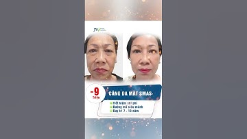 Căng da mặt SMAS Công nghệ tái tạo làn da trẻ hơn 10 tuổi ! Bác sĩ Tú Dung #shorts #benhvienjw