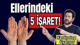 Elindeki Bu 5 İşarete Dikkat! Kalp Yetmezliği Belirtileri