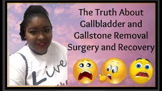 The Truth About Gallbladder and Gallstone Removal Surgery and Recovery