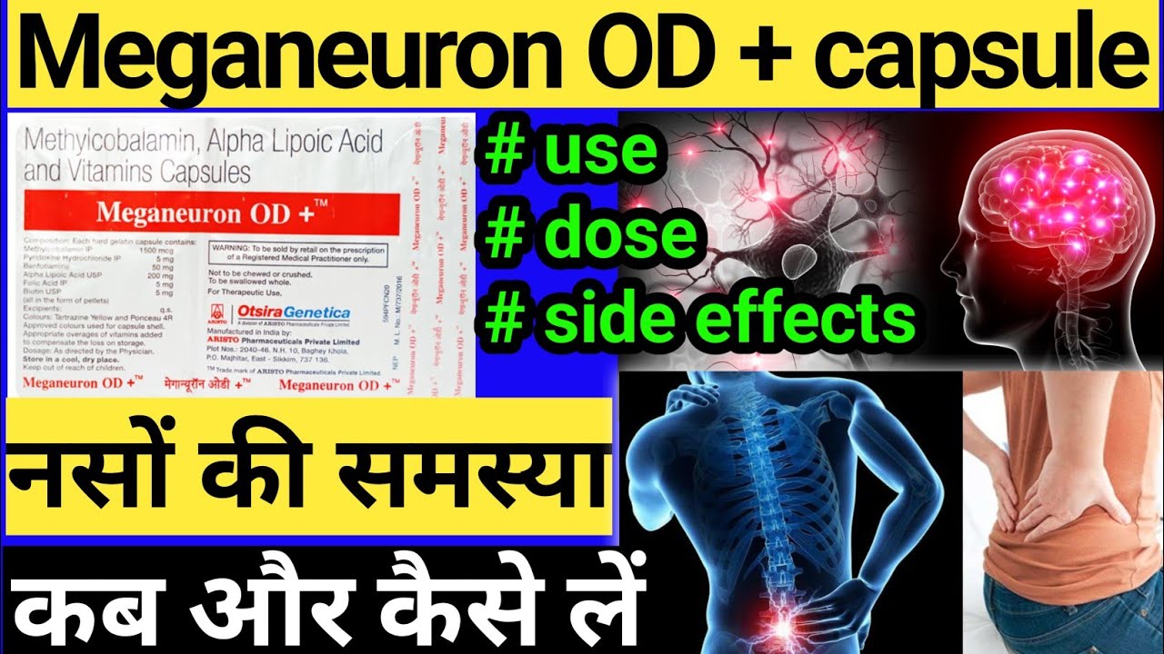 meganeuron-od-capsule-ke-fayade-meganeuron-od-capsule